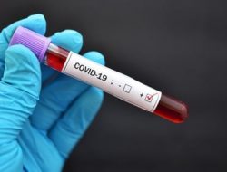 Kemenkes: 2,24 Persen WNI dari Luar Negeri Positif Covid-19