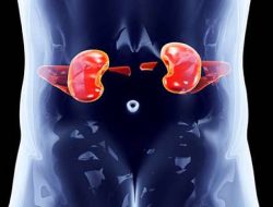 Mengerikan, Berikut Makanan Yang Berpotensi Menimbulkan Kanker