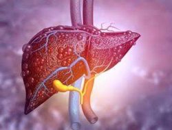 Anggota DPR Usulkan Dua Langkah Atasi Hepatitis Akut