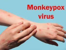 Pemprov DKI Pantau Kasus Cacar Monyet Pertama di Jakarta